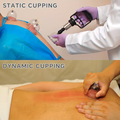 Professional Cupping Set with Pump, Vacuum Suction Cups, Home Use Cupping Kit for Massage