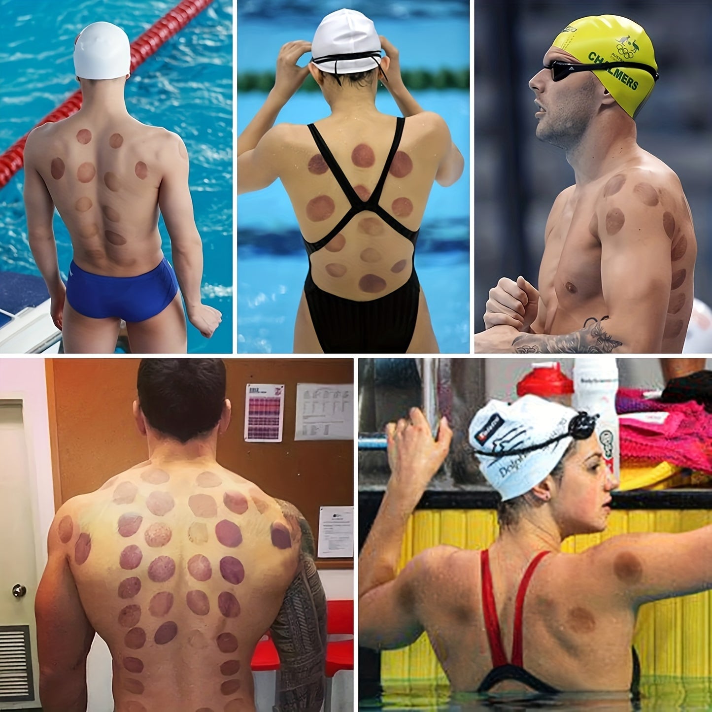 Professional Cupping Set with Pump, Vacuum Suction Cups, Home Use Cupping Kit for Massage